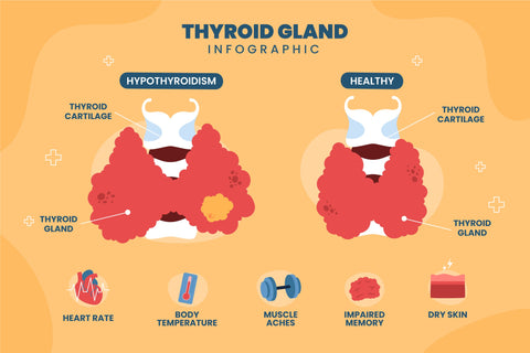 Huile de Nigelle et Thyroïdite de Hashimoto
